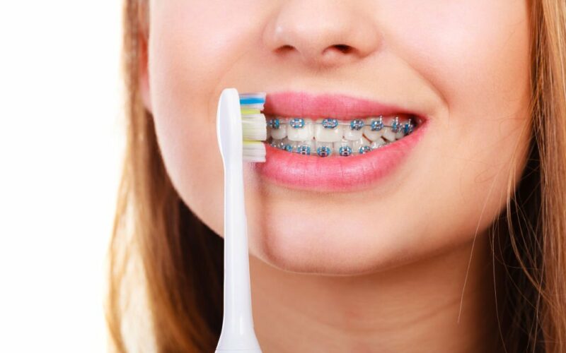 Finding the Best Toothbrush to Keep Your Braces Clean and Healthy